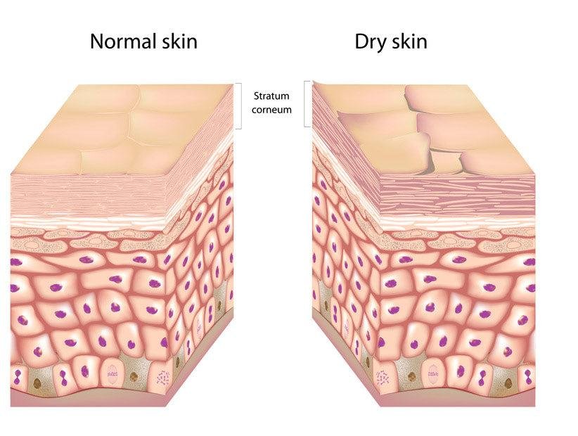 Moisturizer for Dry Aging Skin 