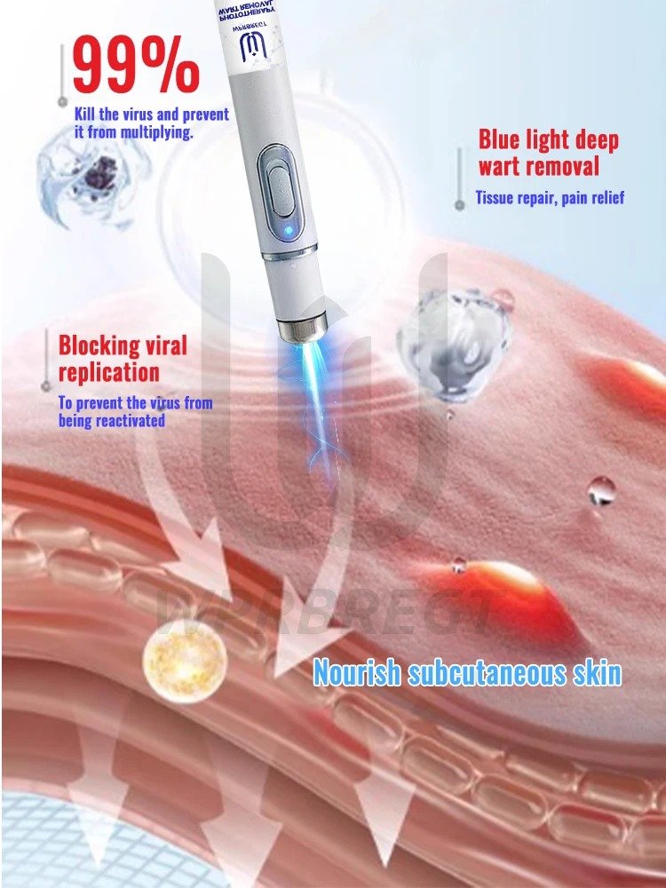 Best wart removal product Australia