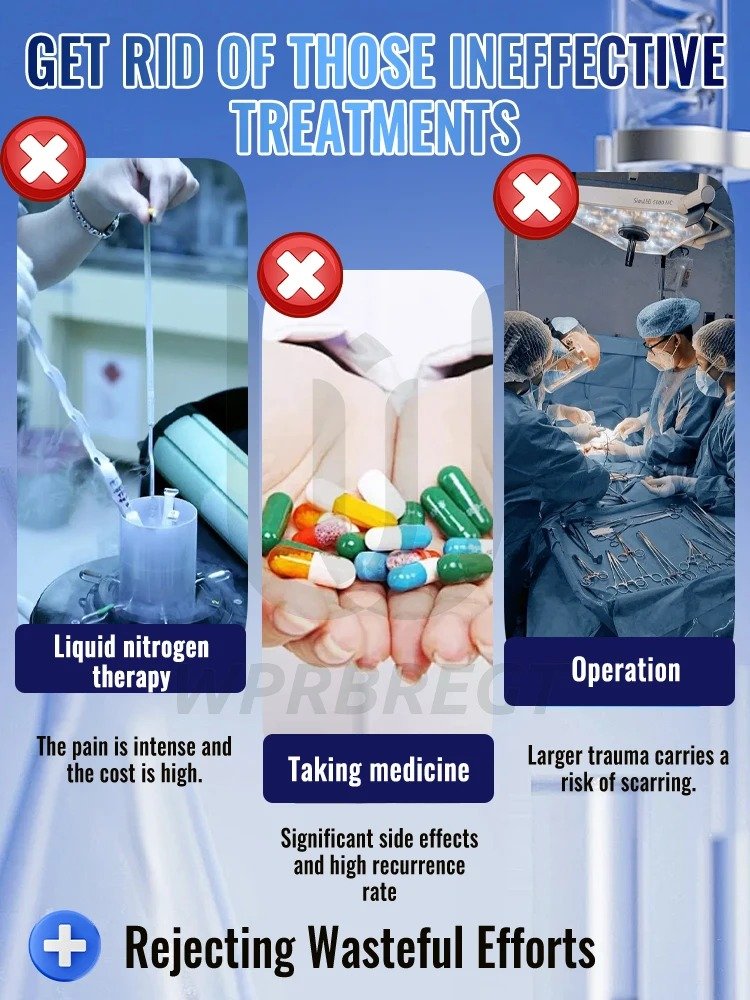 Best wart removal product Australia