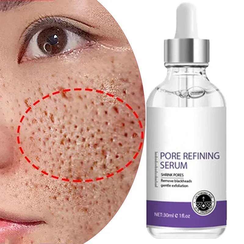 Pore Refining Retinol Niacinamide Serum Australia