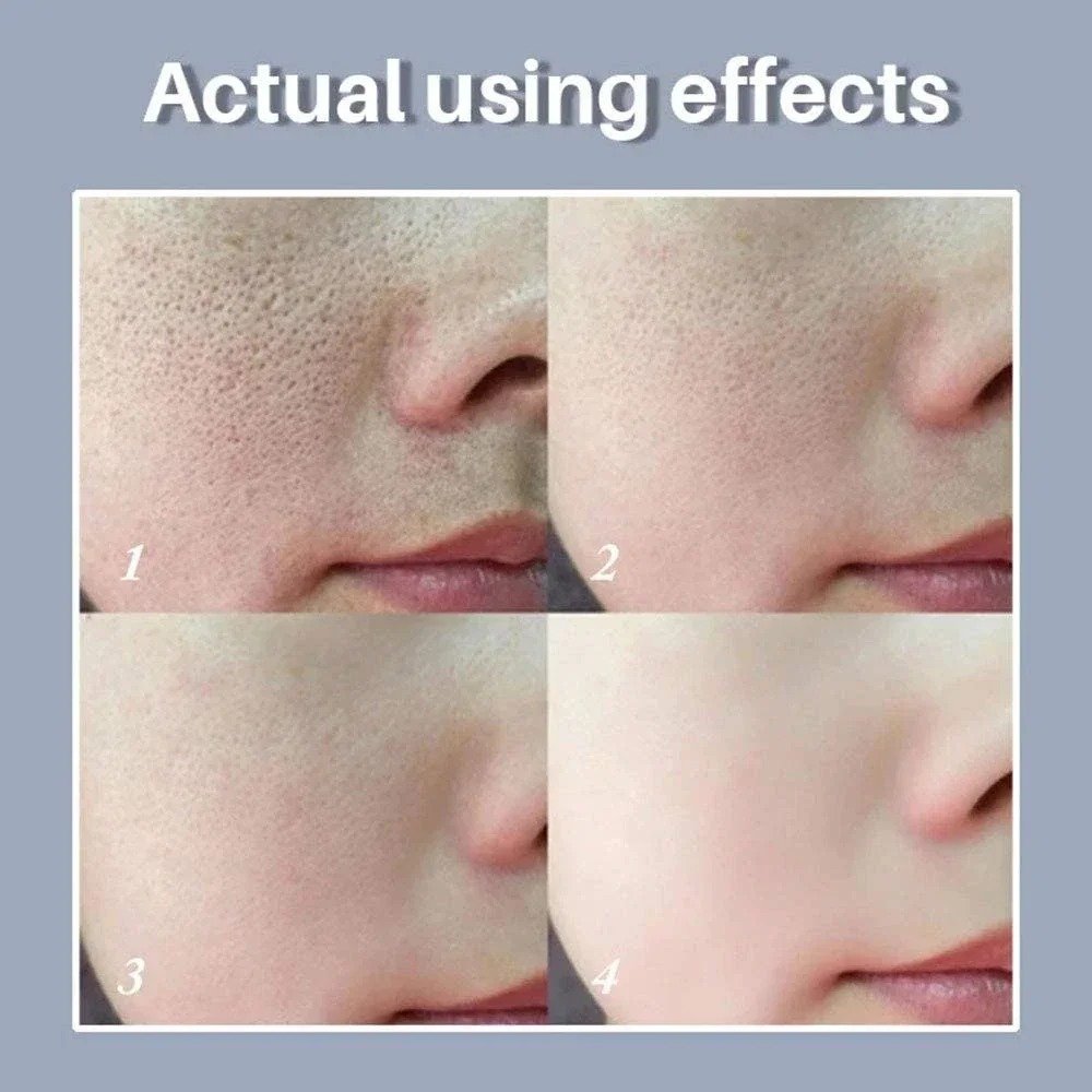  Pore Refining Retinol Niacinamide Serum Australia
