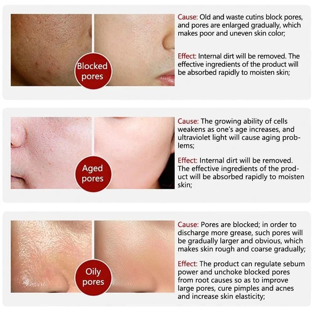 Pore Refining Retinol Niacinamide Serum Australia