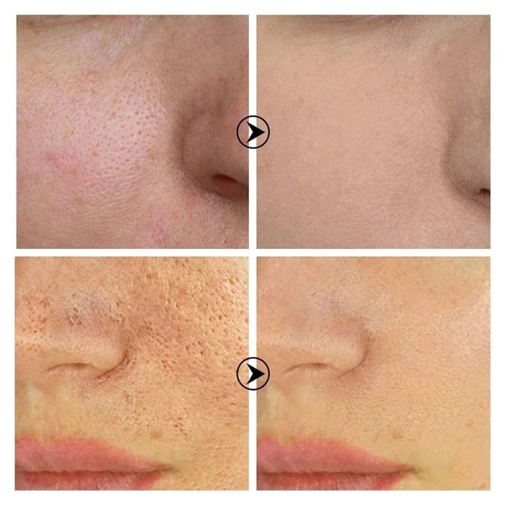  Pore Refining Retinol Niacinamide Serum Australia